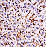 RON Polyclonal Antibody