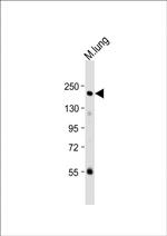 RON Antibody in Western Blot (WB)