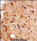 PXK Antibody in Immunohistochemistry (IHC)