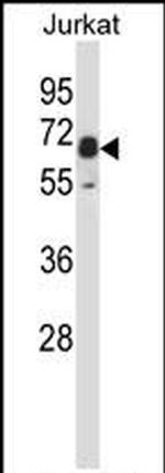 PXK Antibody in Western Blot (WB)