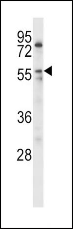LPL Antibody in Western Blot (WB)