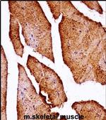 MLK2 Antibody in Immunohistochemistry (IHC)