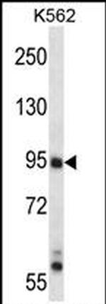 MLK2 Antibody in Western Blot (WB)