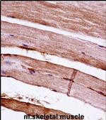 MAPKAPK3 Antibody in Immunohistochemistry (IHC)