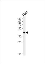 MAPKAPK3 Antibody in Western Blot (WB)