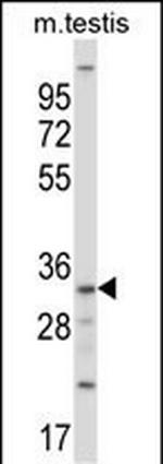 SGK494 Polyclonal Antibody