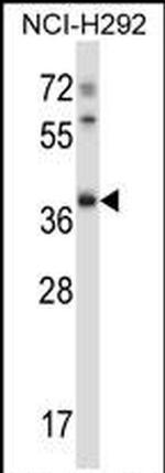 TSSK6 Antibody in Western Blot (WB)
