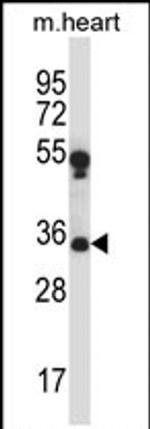 MARCH1 Antibody in Western Blot (WB)