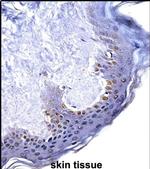 HOXC4 Antibody in Immunohistochemistry (IHC)