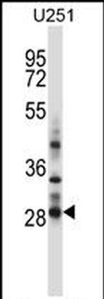 HOXC4 Antibody in Western Blot (WB)