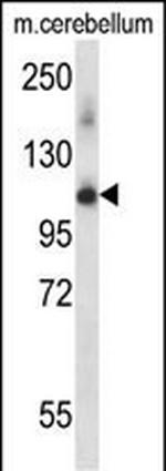 PRPF4B Polyclonal Antibody