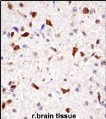 HOXA7 Antibody in Immunohistochemistry (IHC)
