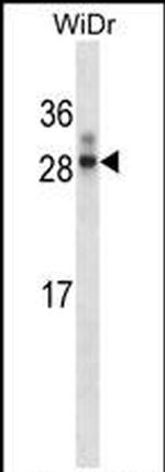 HOXA7 Antibody in Western Blot (WB)