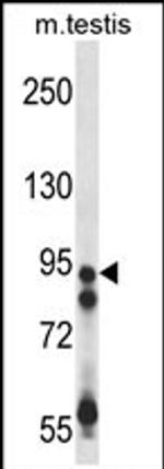 USP20 Antibody in Western Blot (WB)