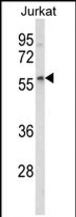 SPRED1 Antibody in Western Blot (WB)