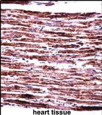 PERP Antibody in Immunohistochemistry (IHC)