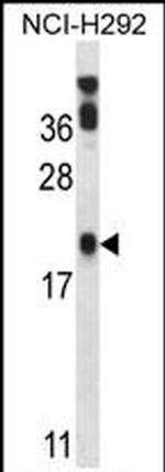 PERP Antibody in Western Blot (WB)