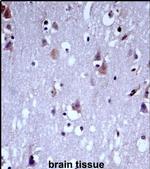 KV3.1 (KCNC1) Antibody in Immunohistochemistry (IHC)