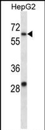KV3.1 (KCNC1) Antibody in Western Blot (WB)