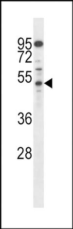 AP2M1 Antibody in Western Blot (WB)
