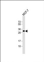Latexin Antibody in Western Blot (WB)