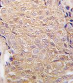 ALDH6A1 Antibody in Immunohistochemistry (IHC)