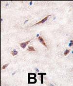 ERAS Antibody in Immunohistochemistry (IHC)