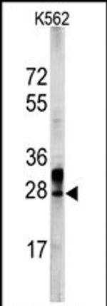 ERAS Antibody in Western Blot (WB)