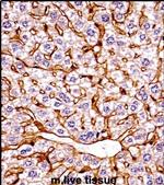 GCN2 Antibody in Immunohistochemistry (IHC)