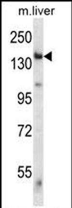 GCN2 Antibody in Western Blot (WB)