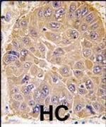 ALDH5A1 Antibody in Immunohistochemistry (IHC)