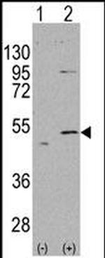 ALDH5A1 Antibody in Western Blot (WB)