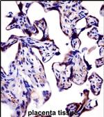 KV1.2 (KCNA2) Antibody in Immunohistochemistry (IHC)