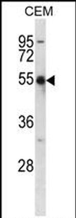 KV1.2 (KCNA2) Antibody in Western Blot (WB)