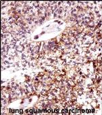 ECT2 Antibody in Immunohistochemistry (IHC)