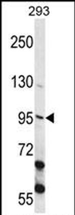ECT2 Antibody in Western Blot (WB)