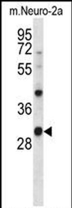 CK1 alpha Antibody in Western Blot (WB)