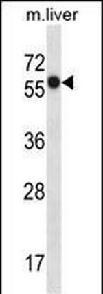Prostein Polyclonal Antibody