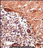 PJA Antibody in Immunohistochemistry (IHC)