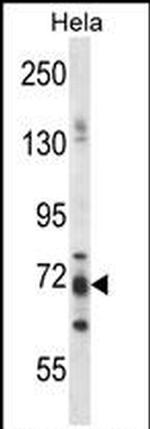 PJA Antibody in Western Blot (WB)