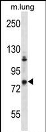GRK3 Antibody in Western Blot (WB)