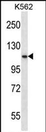 PCSK6 Antibody in Western Blot (WB)