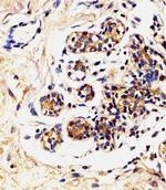 LALBA Antibody in Immunohistochemistry (IHC)
