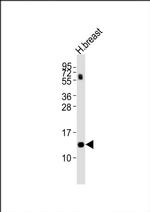 LALBA Antibody in Western Blot (WB)