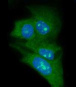 LIN28B Antibody in Immunocytochemistry (ICC/IF)