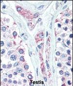 LIN28B Antibody in Immunohistochemistry (Paraffin) (IHC (P))