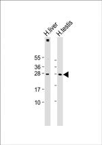 LIN28B Antibody in Western Blot (WB)