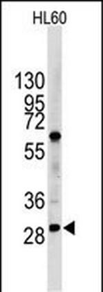 LIN28B Antibody in Western Blot (WB)