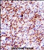 PRSS27 Antibody in Immunohistochemistry (IHC)