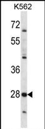 PRSS27 Antibody in Western Blot (WB)
